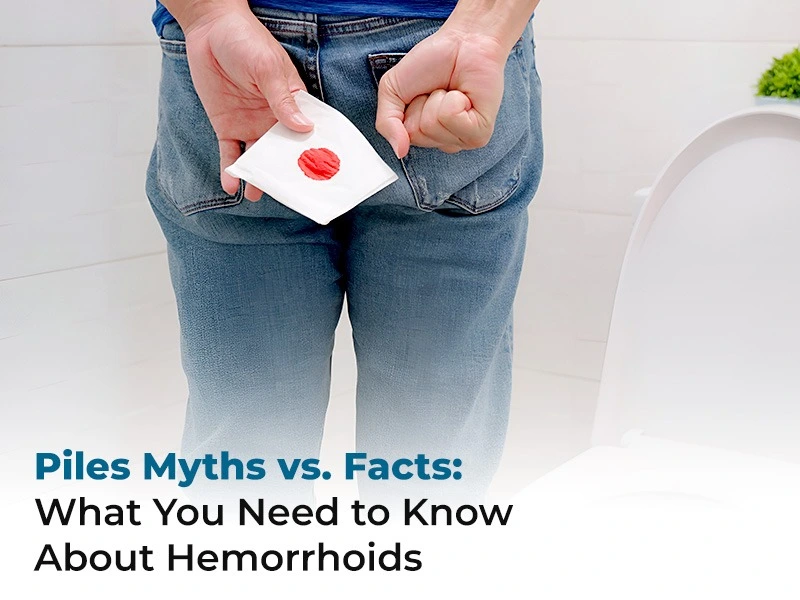 Piles Myths vs. Facts: What You Need to Know About Hemorrhoids